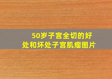 50岁子宫全切的好处和坏处子宫肌瘤图片