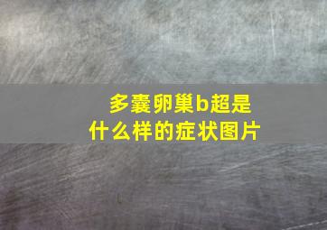 多囊卵巢b超是什么样的症状图片