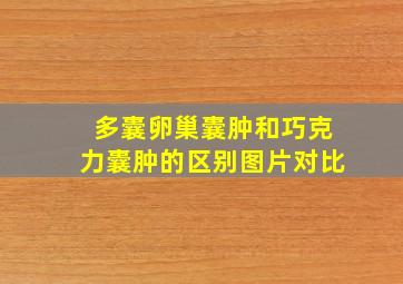 多囊卵巢囊肿和巧克力囊肿的区别图片对比