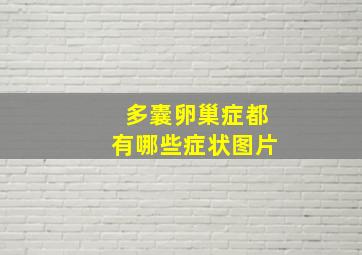 多囊卵巢症都有哪些症状图片