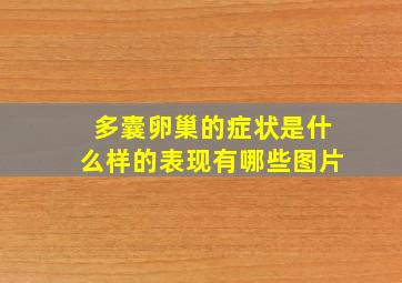 多囊卵巢的症状是什么样的表现有哪些图片