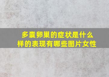 多囊卵巢的症状是什么样的表现有哪些图片女性