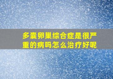 多囊卵巢综合症是很严重的病吗怎么治疗好呢