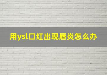 用ysl口红出现唇炎怎么办