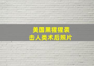 美国黑猩猩袭击人类术后照片