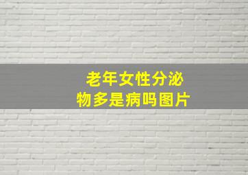 老年女性分泌物多是病吗图片