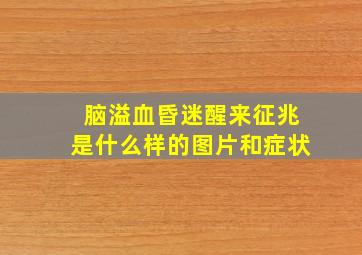 脑溢血昏迷醒来征兆是什么样的图片和症状