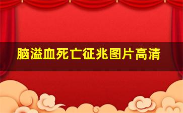 脑溢血死亡征兆图片高清