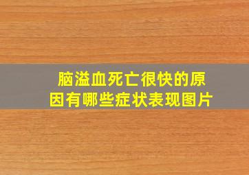 脑溢血死亡很快的原因有哪些症状表现图片