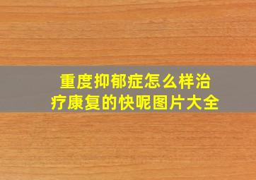 重度抑郁症怎么样治疗康复的快呢图片大全