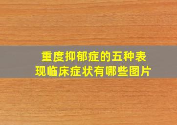 重度抑郁症的五种表现临床症状有哪些图片