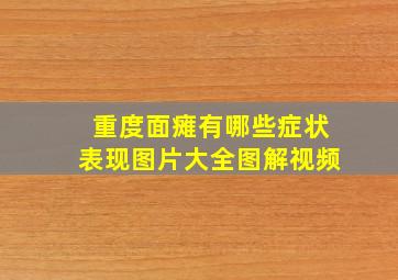 重度面瘫有哪些症状表现图片大全图解视频